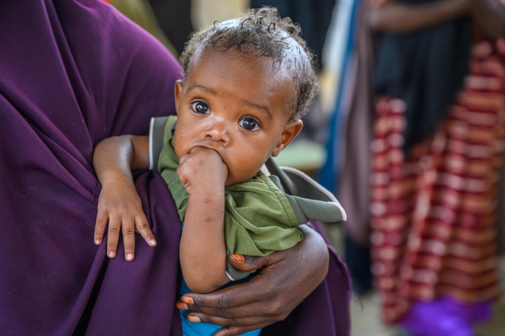 Somalilainen taapero imeskelee nyrkkiään ja katsoo vakavana kameraan.